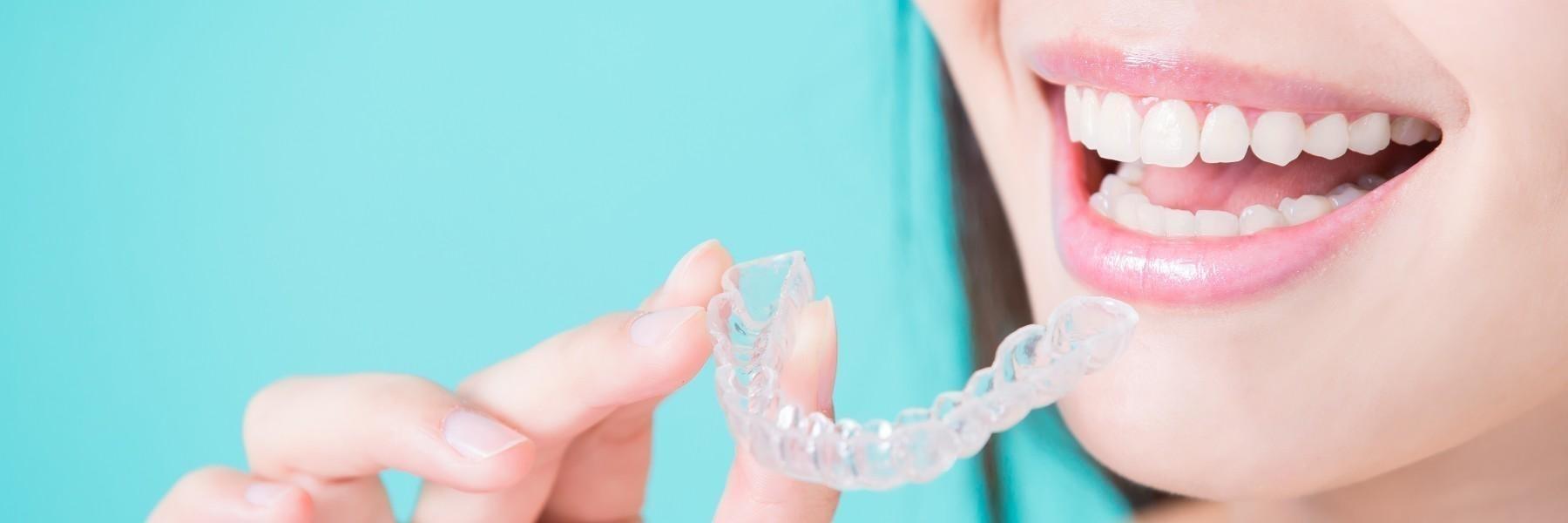 Invisalign® Clear Aligners | Dentist